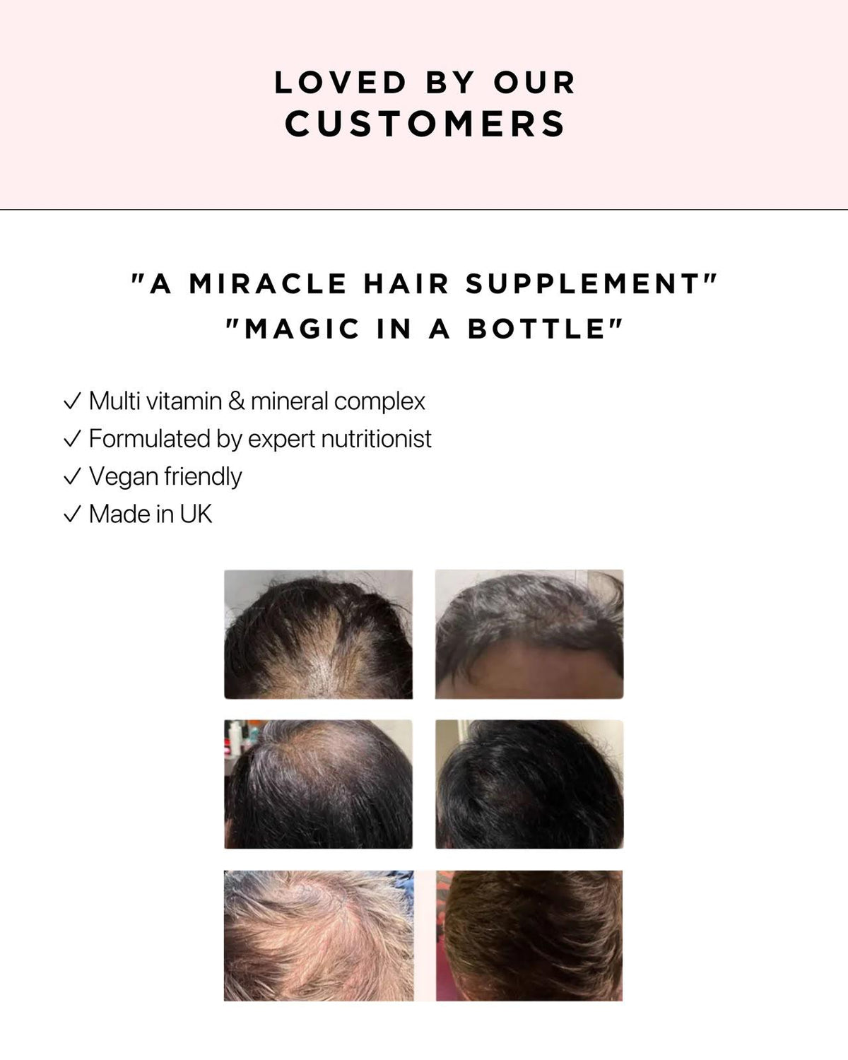 Biotin Bundle